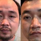 Apartemen Mewah Jadi Persembunyian Tangan Kanan Koh Erwin, Polisi Buru Sosok  The Doctor 