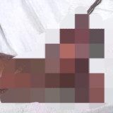 Kaki Pemuda di Pamekasan Hancur Akibat Ledakan saat Merakit Petasan