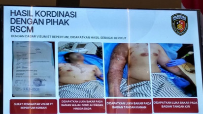 Terungkap, Kondisi Terkini hingga Penampakan Luka Bakar Aktivis KontraS yang Disiram Air Keras