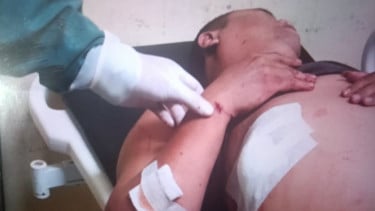 Polres Pasaman Barat Berhasil Tangkap Pelaku Penusukan