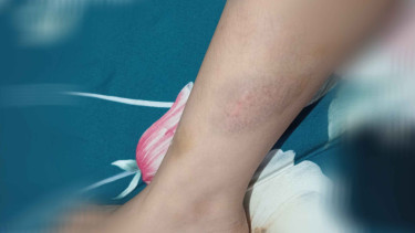 Oknum Polisi di Pacitan Diduga Aniaya Istri dan Anak, Keluarga Tempuh Jalur Hukum