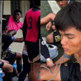 Kondisi Terkini Pemain Dewa United yang Diserang Tendangan Kungfu Eks Timnas Indonesia U-17 Fadly Alberto