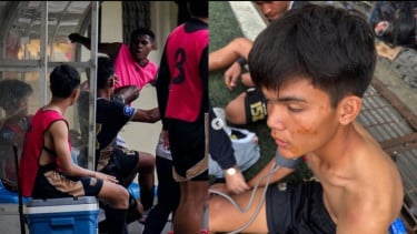 Kondisi Terkini Pemain Dewa United yang Diserang Tendangan Kungfu Eks Timnas Indonesia U-17 Fadly Alberto