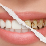 Tips Jaga Gigi Tetap Putih Meski Sering Minum Kopi dan Teh, No.7 Jangan Sampai Lupa!