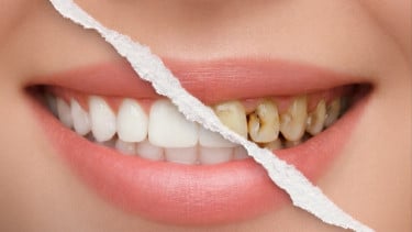 Tips Jaga Gigi Tetap Putih Meski Sering Minum Kopi dan Teh, No.7 Jangan Sampai Lupa!