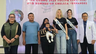 Miss Cosmo 2025 Sambangi RS di Bekasi, Dukung Misi Operasi Sumbing Gratis