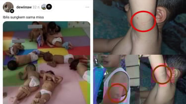 3 Fakta Penganiayaan Massal di Daycare Little Aresha Yogyakarta, Tangan dan Kaki Anak Diikat hingga Idap Gangguan Paru-paru