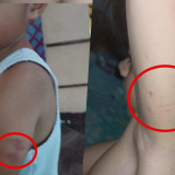 Orang Tua Korban Daycare Little Aresha Curiga Usai Temukan Banyak Luka Misterius di Punggung Anak