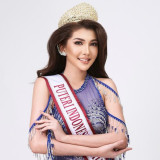 Eks Putri Indonesia Riau 2024 Jadi Tersangka Usai Jadi Dokter Kecantikan Gadungan, Para Korban Alami Cacat Permanen