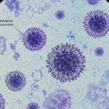 Dinkes Ungkap Ada 4 Kasus Hantavirus di Jakarta pada 2026, Tiga Pasien Sudah Sembuh