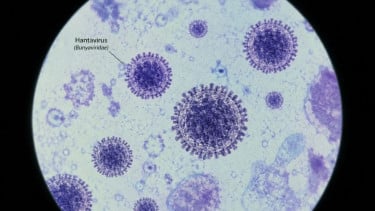 Dinkes Ungkap Ada 4 Kasus Hantavirus di Jakarta pada 2026, Tiga Pasien Sudah Sembuh