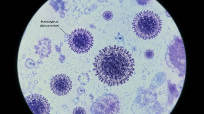Dinkes Ungkap Ada 4 Kasus Hantavirus di Jakarta pada 2026, Tiga Pasien Sudah Sembuh