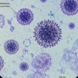 Dinkes DKI Temukan 3 Kasus Positif Hantavirus di Jakarta, 6 Orang Masih Suspek