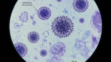 Dinkes DKI Temukan 3 Kasus Positif Hantavirus di Jakarta, 6 Orang Masih Suspek