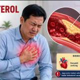 7 Tips Cegah Kolesterol saat Daging Kurban Melimpah, Nomor 1 Pilih Bagian Daging yang Seperti Ini