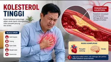 7 Tips Cegah Kolesterol saat Daging Kurban Melimpah, Nomor 1 Pilih Bagian Daging yang Seperti Ini