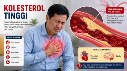 7 Tips Cegah Kolesterol saat Daging Kurban Melimpah, Nomor 1 Pilih Bagian Daging yang Seperti Ini