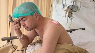 Mengenal Lipoma, Benjolan yang Diidap hingga Buat Raffi Ahmad Harus Menjalani Operasi