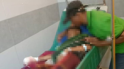 Bungkusan Bom Ikan Meledak, Dua Bocah di Nganjuk Alami Luka Parah