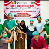Sambut Hari Bhayangkara ke-80, Polda Gorontalo Gelar Operasi Bibir Sumbing Gratis untuk 20 Anak