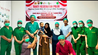 Sambut Hari Bhayangkara ke-80, Polda Gorontalo Gelar Operasi Bibir Sumbing Gratis untuk 20 Anak