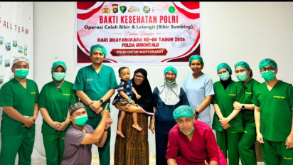 Sambut Hari Bhayangkara ke-80, Polda Gorontalo Gelar Operasi Bibir Sumbing Gratis untuk 20 Anak