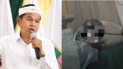 Seluruh Biaya Pengobatan Korban Penyiksaan dan Penyekapan 3 Tahun oleh Pacar Ditanggung Pemprov Jabar