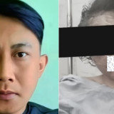 Taufik Hidayat Jadi Tersangka, Polisi Bongkar Luka-luka Mengerikan YTR Selama Disekap dan Disiksa 3 Tahun