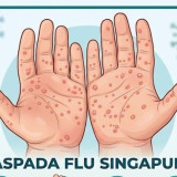 Flu Singapura Bisa Menyerang Orang Dewasa, Dokter: Segera Periksakan