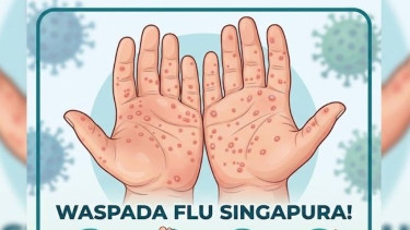 Flu Singapura Bisa Menyerang Orang Dewasa, Dokter: Segera Periksakan