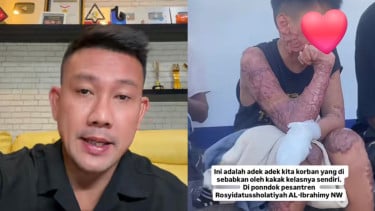 Ternyata Ini Alasan Korban pada Kasus Dugaan Pembakaran Santri Batal Datang ke Podcast Denny Sumargo
