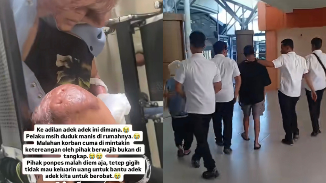 Diduga jadi Korban Bullying, Kasus Dugaan Pembakaran Santri di NTB Naik ke Tahap Penyidikan dengan Alasan Ini
            - galeri foto