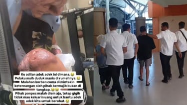 Diduga jadi Korban Bullying, Kasus Dugaan Pembakaran Santri di NTB Naik ke Tahap Penyidikan dengan Alasan Ini