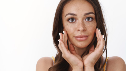 Lebih dari 90 Persen Penderita Melasma Perempuan, Ini Faktor Penyebabnya