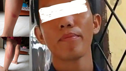 Respons Tegas Pemerhati Anak dan Pendidikan soal Kasus Dugaan Kekerasan pada Murid di Lubuklinggau