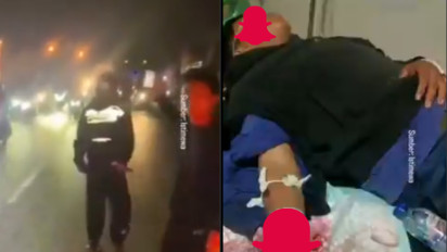 Aksi "Bang Jago" Ikut Tawuran di Karawang, Seorang Pelajar Kehilangan Pergelangan Tangan Akibat Sajam