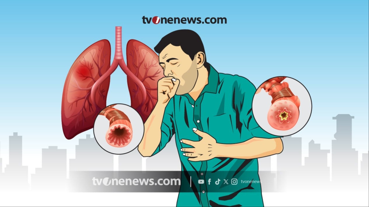 Simak 4 Cara Mendiagnosis Pneumonia, Sebanyak 617 Kasus Ditemukan di Jombang
            - galeri foto