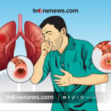 Simak 4 Cara Mendiagnosis Pneumonia, Sebanyak 617 Kasus Ditemukan di Jombang