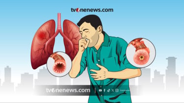 Simak 4 Cara Mendiagnosis Pneumonia, Sebanyak 617 Kasus Ditemukan di Jombang