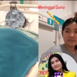 Operasi Ambeien Bisa Sebabkan Kematian? Ini Penjelasan Medis di Tengah Sorotan Kasus Dewi Sartika