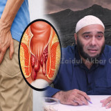 Ambeien Bikin BAB Tak Nyaman? dr. Zaidul Akbar Ungkap 3 Herbal yang Bisa Bantu Meredakan