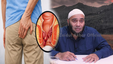 Ambeien Bikin BAB Tak Nyaman? dr. Zaidul Akbar Ungkap 3 Herbal yang Bisa Bantu Meredakan