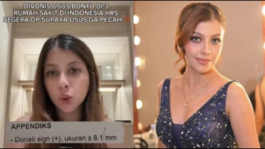 Siapa Fahira Almira? Selebgram Adik Sarah Keihl yang Viral soal Dugaan Salah Diagnosis Usus Buntu