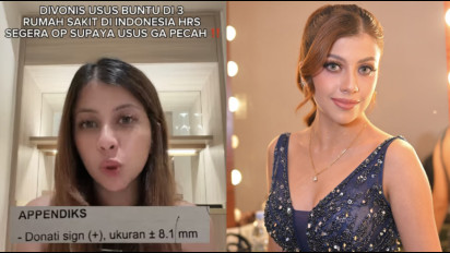 Siapa Fahira Almira? Selebgram Adik Sarah Keihl yang Viral soal Dugaan Salah Diagnosis Usus Buntu