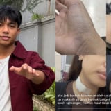 Kumpulan Fakta Dugaan Kasus Kekerasan Seksual Betrand Peto, Korban Luka-luka hingga Mengaku Trauma