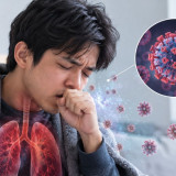 Kasus Influenza A di Indonesia Muncul di Beberapa Wilayah, IDAI Ingatkan Ada Peluang Komplikasi pada Kelompok Rentan
