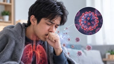 Kasus Influenza A di Indonesia Muncul di Beberapa Wilayah, IDAI Ingatkan Ada Peluang Komplikasi pada Kelompok Rentan