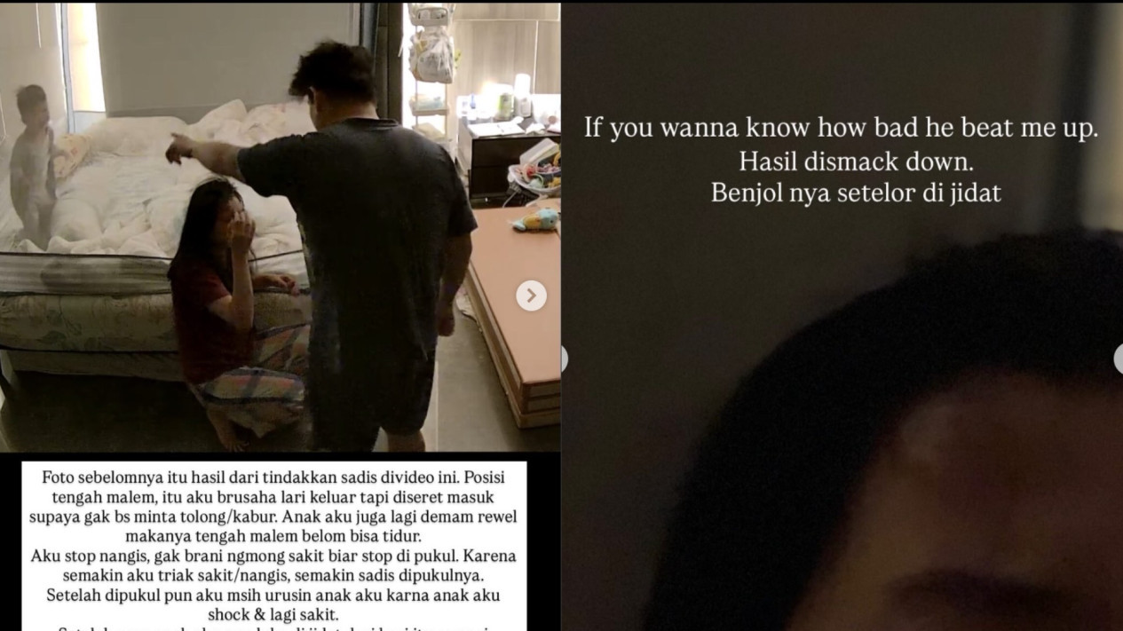 Viral Dugaan KDRT di Depan Anak, Istri Ungkap Kronologi Kekerasan hingga Luka Diobati Sendiri
            - galeri foto