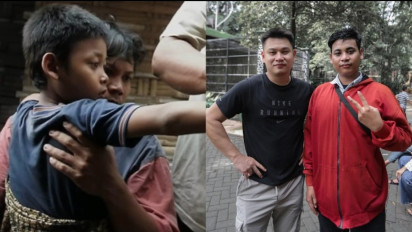 Ingat Ponari? Bocil yang Bisa Obati Penyakit dari Batu Dicelup Air, Kini Kuliah Farmasi