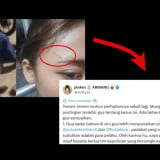 Kakak Korban Penganiayaan di Tambora Minta Maaf, Sebut Polsek Tambora dan Polres Jakbar Sudah Gerak Cepat